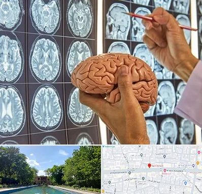 جراح مغز و اعصاب در هشت بهشت اصفهان 