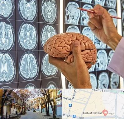 جراح مغز و اعصاب در تربیت تبریز
