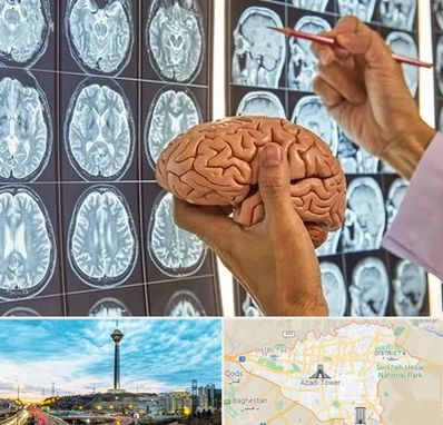جراح مغز و اعصاب در تهران