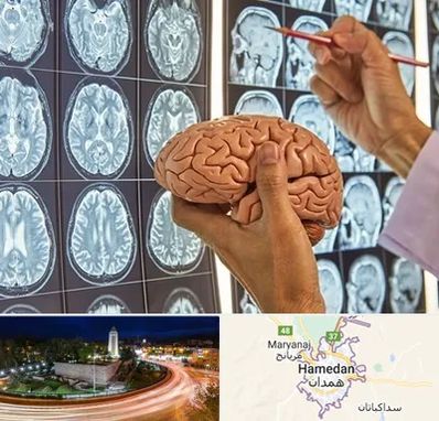 جراح مغز و اعصاب در همدان
