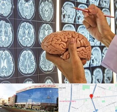 جراح مغز و اعصاب در نصف راه تبریز