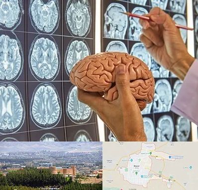 جراح مغز و اعصاب در بیرجند