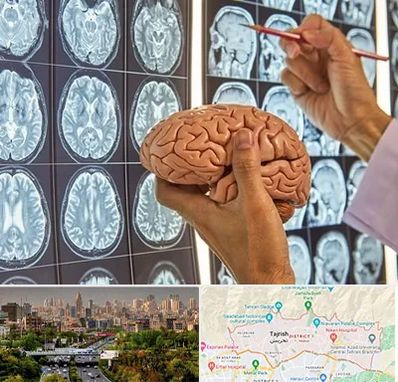 جراح مغز و اعصاب در منطقه 1 تهران 