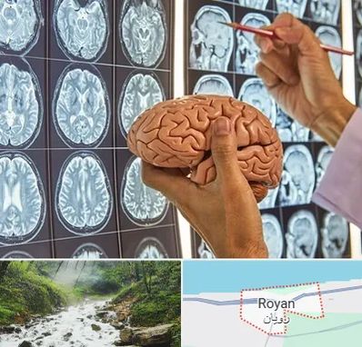 دکتر فوق تخصص جراح مغز و اعصاب در رویان