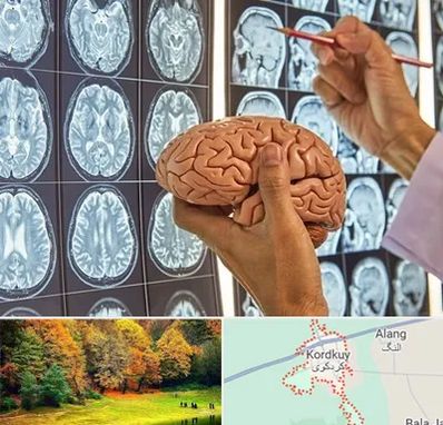 دکتر فوق تخصص جراح مغز و اعصاب در کردکوی