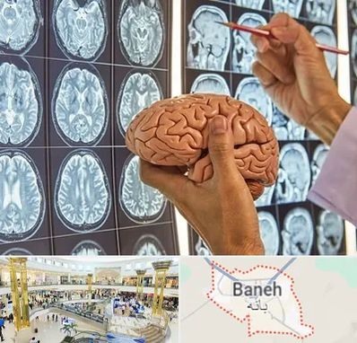دکتر فوق تخصص جراح مغز و اعصاب در بانه