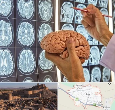 دکتر فوق تخصص جراح مغز و اعصاب در بم