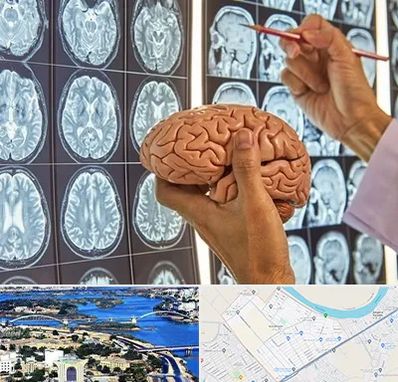 دکتر فوق تخصص جراح مغز و اعصاب در کوروش اهواز 