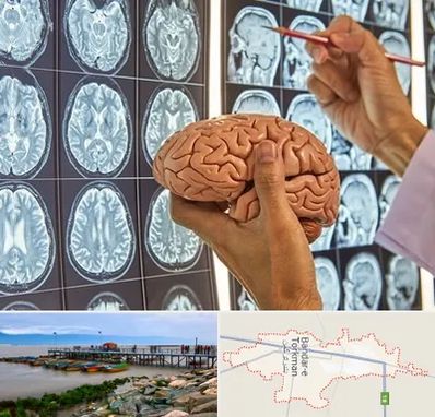 دکتر فوق تخصص جراح مغز و اعصاب در بندر ترکمن