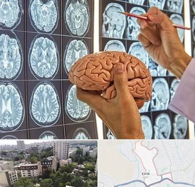 دکتر فوق تخصص جراح مغز و اعصاب در اوین