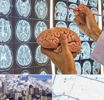 دکتر فوق تخصص جراح مغز و اعصاب در ازگل