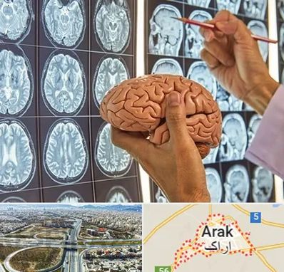 دکتر فوق تخصص جراح مغز و اعصاب در اراک