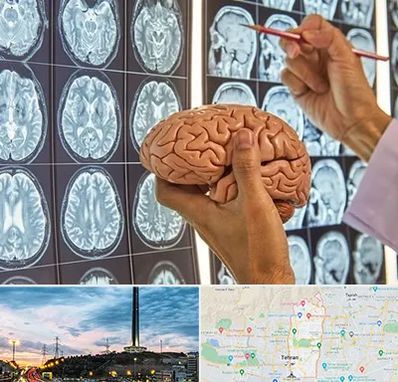 دکتر فوق تخصص جراح مغز و اعصاب در منطقه 2 تهران 