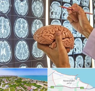 دکتر فوق تخصص جراح مغز و اعصاب در نوشهر