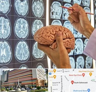 دکتر فوق تخصص جراح مغز و اعصاب در سهروردی 