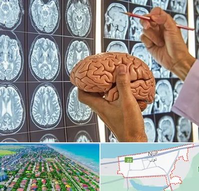 دکتر فوق تخصص جراح مغز و اعصاب در نور