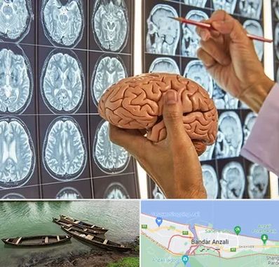 دکتر فوق تخصص جراح مغز و اعصاب در بندر انزلی