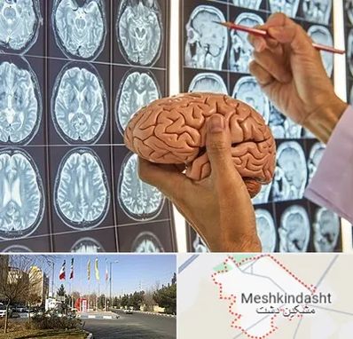 دکتر فوق تخصص جراح مغز و اعصاب در مشکین دشت