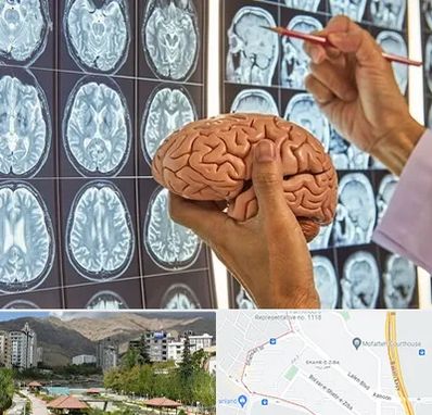 دکتر فوق تخصص جراح مغز و اعصاب در شهر زیبا 