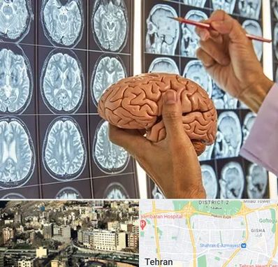 دکتر فوق تخصص جراح مغز و اعصاب در مرزداران 