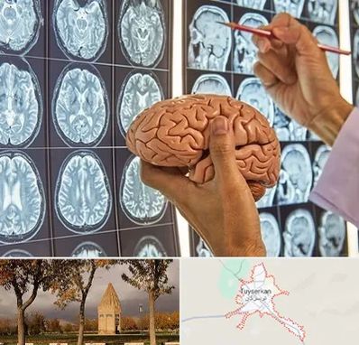 دکتر فوق تخصص جراح مغز و اعصاب در تویسرکان