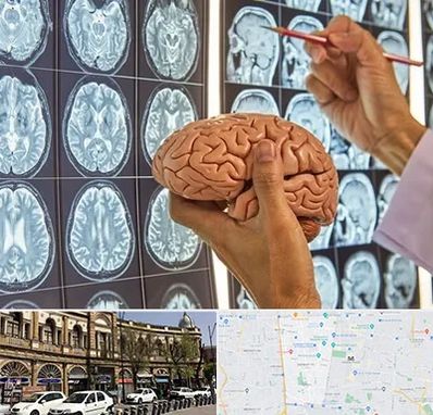 دکتر فوق تخصص جراح مغز و اعصاب در منطقه 11 تهران 