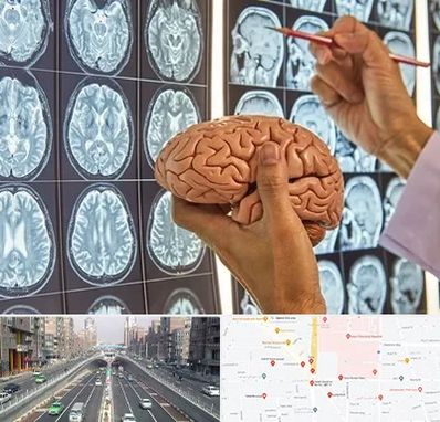 دکتر فوق تخصص جراح مغز و اعصاب در توحید 