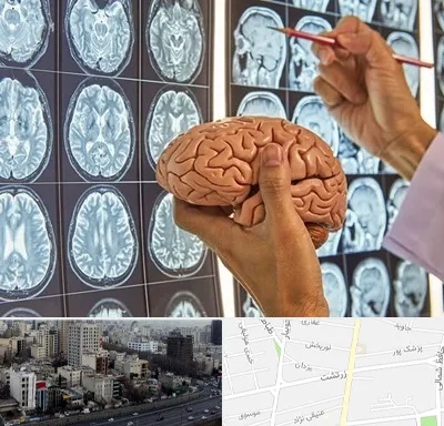دکتر فوق تخصص جراح مغز و اعصاب در زرتشت