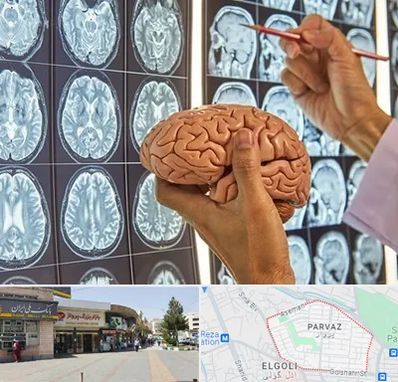 دکتر فوق تخصص جراح مغز و اعصاب در پرواز تبریز