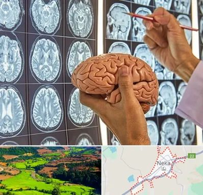 دکتر فوق تخصص جراح مغز و اعصاب در نکا