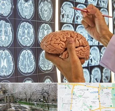 دکتر فوق تخصص جراح مغز و اعصاب در باغ فیض 