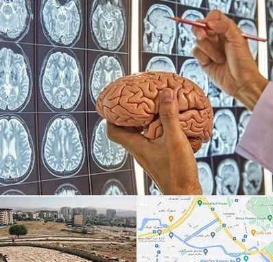 دکتر فوق تخصص جراح مغز و اعصاب در کوی وحدت شیراز 