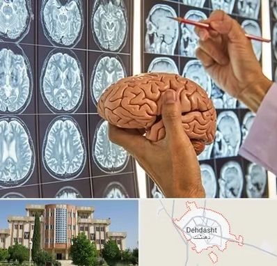 دکتر فوق تخصص جراح مغز و اعصاب در دهدشت