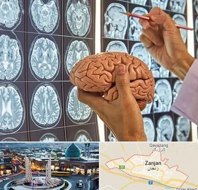 دکتر فوق تخصص جراح مغز و اعصاب در زنجان