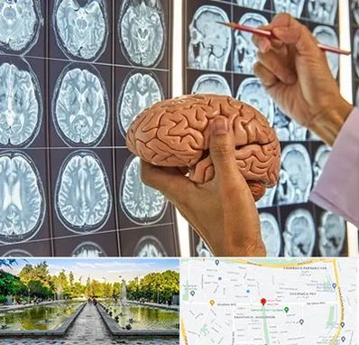 دکتر فوق تخصص جراح مغز و اعصاب در سرسبز 