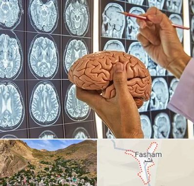 دکتر فوق تخصص جراح مغز و اعصاب در فشم