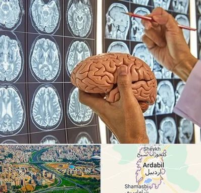 دکتر فوق تخصص جراح مغز و اعصاب در اردبیل