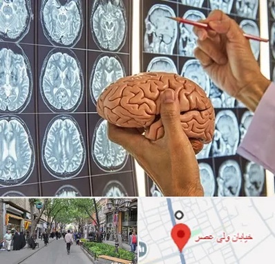 دکتر فوق تخصص جراح مغز و اعصاب در ولیعصر شهریار