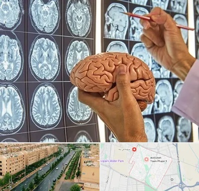 دکتر فوق تخصص جراح مغز و اعصاب در فاز سه اندیشه