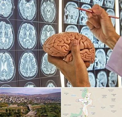 دکتر فوق تخصص جراح مغز و اعصاب در بوکان