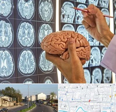 دکتر فوق تخصص جراح مغز و اعصاب در ضیابری رشت 