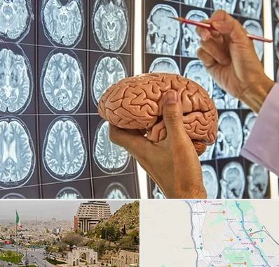 دکتر فوق تخصص جراح مغز و اعصاب در فرهنگ شهر شیراز 