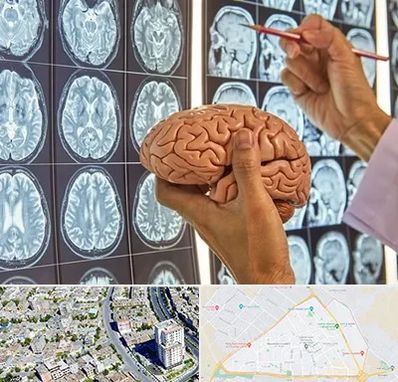 دکتر فوق تخصص جراح مغز و اعصاب در قاسم آباد مشهد 