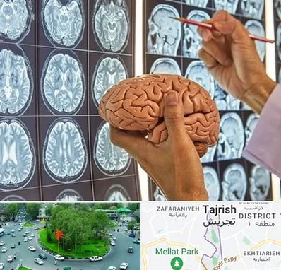 دکتر فوق تخصص جراح مغز و اعصاب در تجریش 