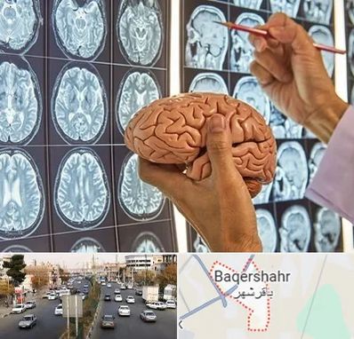 دکتر فوق تخصص جراح مغز و اعصاب در باقرشهر
