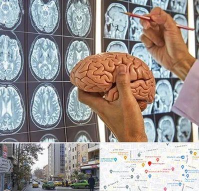 دکتر فوق تخصص جراح مغز و اعصاب در فاطمی 