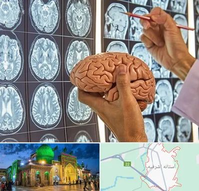 دکتر فوق تخصص جراح مغز و اعصاب در آستانه اشرفیه