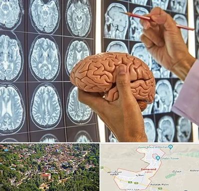دکتر فوق تخصص جراح مغز و اعصاب در دماوند