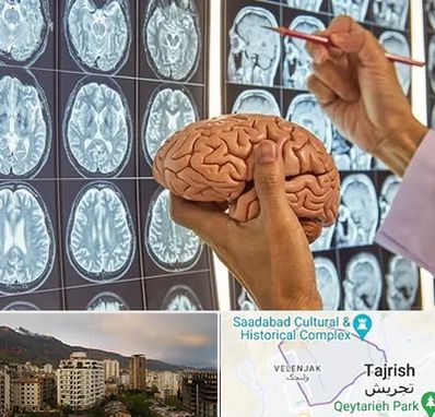 دکتر فوق تخصص جراح مغز و اعصاب در زعفرانیه 