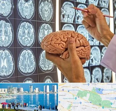 دکتر فوق تخصص جراح مغز و اعصاب در چیتگر 